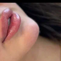 اف تزریق ژل روسی،عربی،خلیجی، بوتاکس|خدمات آرایشگری و زیبایی|شیراز, شهرک امیر کبیر|دیوار