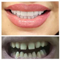 ارائه خدمات زیبایی و درمانی دندانپزشکی|خدمات آرایشگری و زیبایی|کرمانشاه, |دیوار