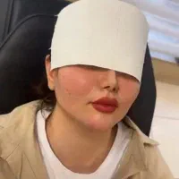 لیپوساکشن|خدمات آرایشگری و زیبایی|بروجرد, |دیوار