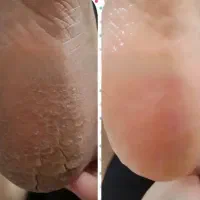 مدل کاشت ناخن*پدیکور و کفسابی پا*احیاوصافی مو|خدمات آرایشگری و زیبایی|کرمان, |دیوار