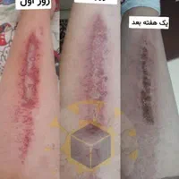 معجزه درمان|آرایشی، بهداشتی، درمانی|فسا, |دیوار