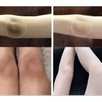 کرم سفید کننده اصلی|آرایشی، بهداشتی، درمانی|بومهن, |دیوار