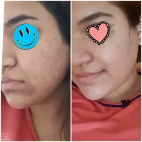 صابون روشن کننده|آرایشی، بهداشتی، درمانی|برازجان, |دیوار