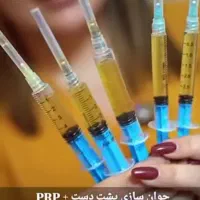 بمب تخفیف خدمات زیبایی ژل بوتاکس جوانساز بادی|خدمات آرایشگری و زیبایی|اهر, |دیوار