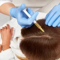 جلوگیری از ریزش مو prp تخفیفات توسط پزشک