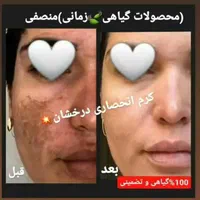 (کرم ضدلک و روشن کننده درخشان)بدون بازگشت|آرایشی، بهداشتی، درمانی|شیراز, قصرالدشت|دیوار