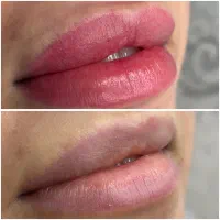 شیدینگ لب تخصصی زیر نظر پزشک