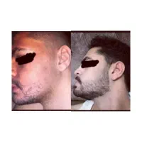 تا ۲۰ روز دیگه ریش داری