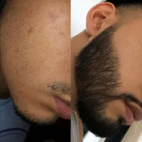 جذابیت رو به چهرت برگردون