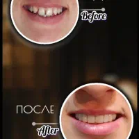 دندانپزشکی اقساطی باارائه وام و با کیفیتی استثنایی|خدمات آرایشگری و زیبایی|شیراز, ملاصدرا|دیوار