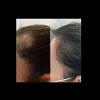 محلول مو و ابرو ،ریش مژه|آرایشی، بهداشتی، درمانی|قم, دورشهر|دیوار