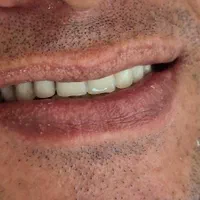 دندانسازی بانو دنت.با چک|خدمات آرایشگری و زیبایی|تربت‌حیدریه, داروپخش|دیوار