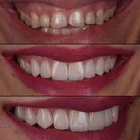 دندانپزشکی،ایمپلنت،ارتودنسی لمینت وکامپوزیت اقساطی|خدمات آرایشگری و زیبایی|نجف‌آباد, شریعتی غربی|دیوار