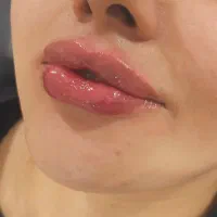 آموزش صفرتا۱۰۰ همه مباحث تزریق فیلر ژل بادی بوتاکس|خدمات آموزشی|شیراز, شریف‌آباد|دیوار