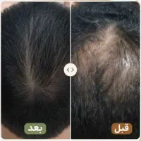 روغن خالص  رایگان