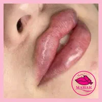 آموزش ژل فیلربوتاکس پرسینگ شیدینگ لب|خدمات آموزشی|قم, شهرک قدس|دیوار