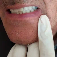 ساخت دندان مصنوعی در سنندج