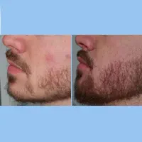 پسرا حق ندارن ببینن