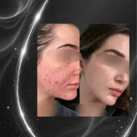 ایرانا»دکتر کامبیز محمدپور»Rf فرکشنال.آفر ویژه ۴ م