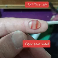نگین انگشتر