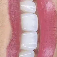 نیازمند دکتر دندانپزشک در شهرری و ژل بوتاکس