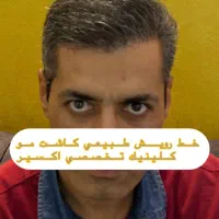 کاشت مو ابرو ریش کلینیک تخصصی اکسیر اقساطی