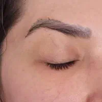 جراحی لیفت شقیقه‌و‌صورت‌سانترال‌لب‌بلفارو‌ اقساط۱۸|خدمات آرایشگری و زیبایی|خرم‌آباد, |دیوار