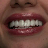 دندانپزشکی تخصصی ایمپلنت، روکش،ارتودنسی، لمینت