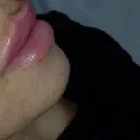 پیرسینگ حرفه ای وتزریق ژل هرسی سی از 550
