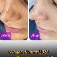 فیشالیست حرفه ای