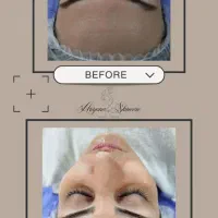 آموزش تخصصی و خدمات پوست (کلینیک زیبایی رویال)