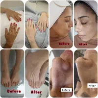 پاکسازی و فشیال حرفه ای خانم واقا