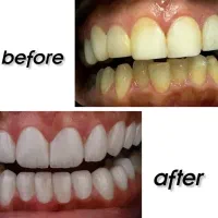 دندان پزشکی|خدمات آرایشگری و زیبایی|قم, نوقطار|دیوار