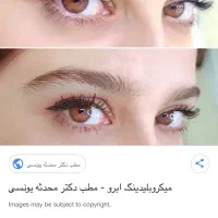 انجام خدمات میکرو