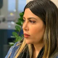 عمل زیبایی بینی با فیش حقوقی