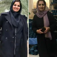 دیگه نگران چاقی و وزن زیادت نباش|آرایشی، بهداشتی، درمانی|مشهد, اروند|دیوار