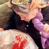 حجامت ،فصدوزالو،سم زدا ویونیزاسیون ماساژ درمانی|خدمات آرایشگری و زیبایی|سنندج, |دیوار