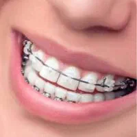 دندانپزشکی ارتودنسی دندان زیبایی صورت|خدمات آرایشگری و زیبایی|مشهد, جنت|دیوار