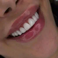 زیبایی دندان با کامپوزیت اصل فقط واحدی یک ملیون