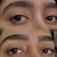 اصلاح تخصصی همراه هیدروژن تراپی رایگان