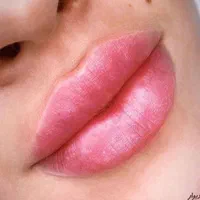 تزریق ژل لب روسی بوتاکس چشم گربه ای فیلرزیرچشم|خدمات آرایشگری و زیبایی|تهران, ستارخان|دیوار