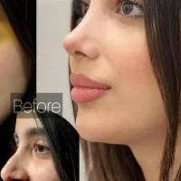 جشنواره جراحی زیبایی بینی ، پیکر تراشی و...|خدمات آرایشگری و زیبایی|تهران, جوادیه تهرانپارس|دیوار