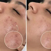 فیشال آقایانو بانوان تنظیف وعنایةاحترافیة بالبشرة|خدمات زیبایی و سلامت|مشهد, احمدآباد|دیوار