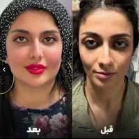 جشنواره ی ۵۰ درصد آف ویژه ی ژل بوتاکس توسط پزشک|خدمات آرایشگری و زیبایی|کرمانشاه, |دیوار