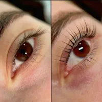 لیفت ابرو و مژه