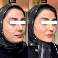 تزریق تخصصی فیلر بوتاکس جوانساز prp مزومو ژل