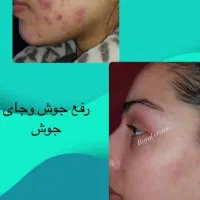 کرم رویال وصابون|آرایشی، بهداشتی، درمانی|لردگان, |دیوار