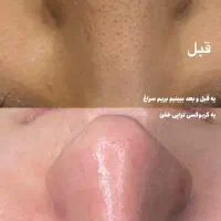 فیشیال تخصصی