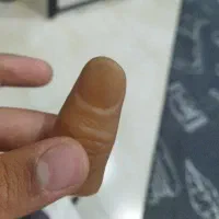 انگشت شعبده