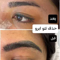 لیزر مو زائدآقاخانم(کل بدن رایگان) شعبه دوم|خدمات آرایشگری و زیبایی|نجف‌آباد, بازار|دیوار